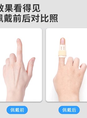 手指骨折固定指套夹板弯曲矫正器小中指护套康复支具护指大拇指