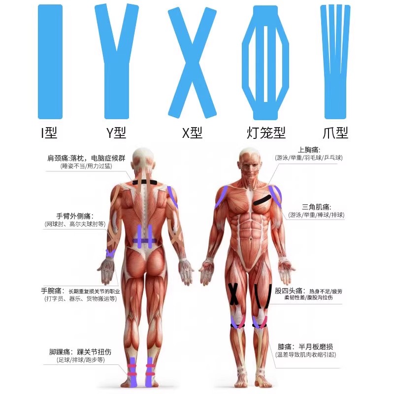 运动肌肉贴自粘弹力绷带预防拉伤绑带肌内效贴胶带布跑步篮球专业 - 图0