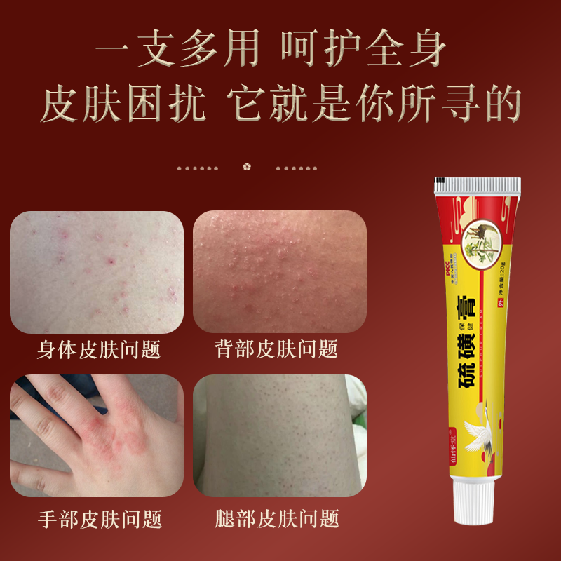 硫磺软膏正品官方旗舰店复方乳膏止痒抑菌皮肤外用全身痒阴虱螨虫 - 图1