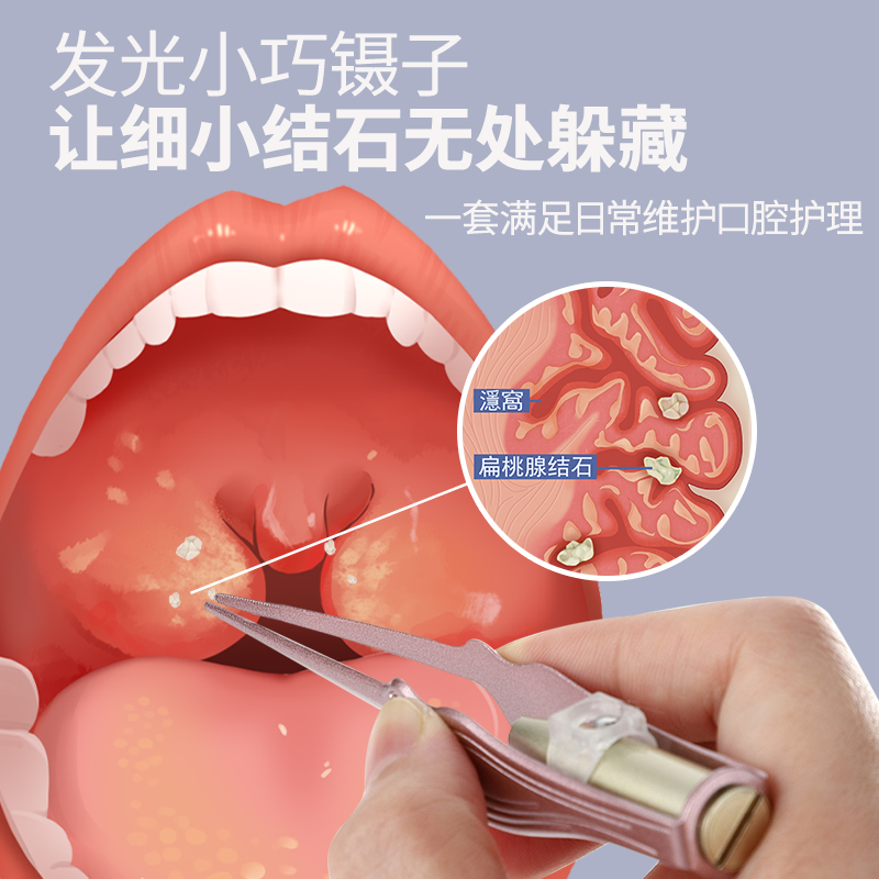 扁桃体结石工具去除取出隐窝神器扁导体去口气口臭家用扁桃体结石 - 图0