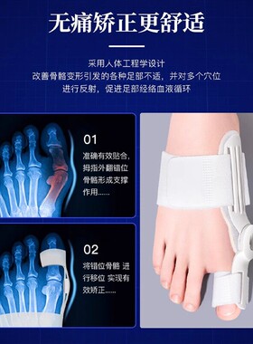 脚趾矫正器大拇指外翻拇指分趾器