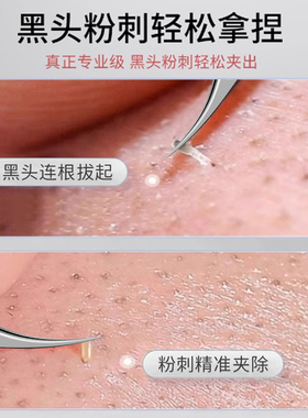 【全网热销100W+】细胞夹第一名!