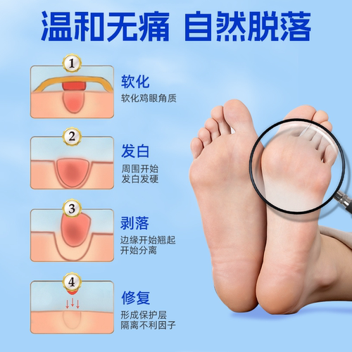 北京同仁堂鸡眼贴鸡眼膏鸡贴眼膏鸡茧膏水杨酸去除老茧脚底肉刺 - 图1