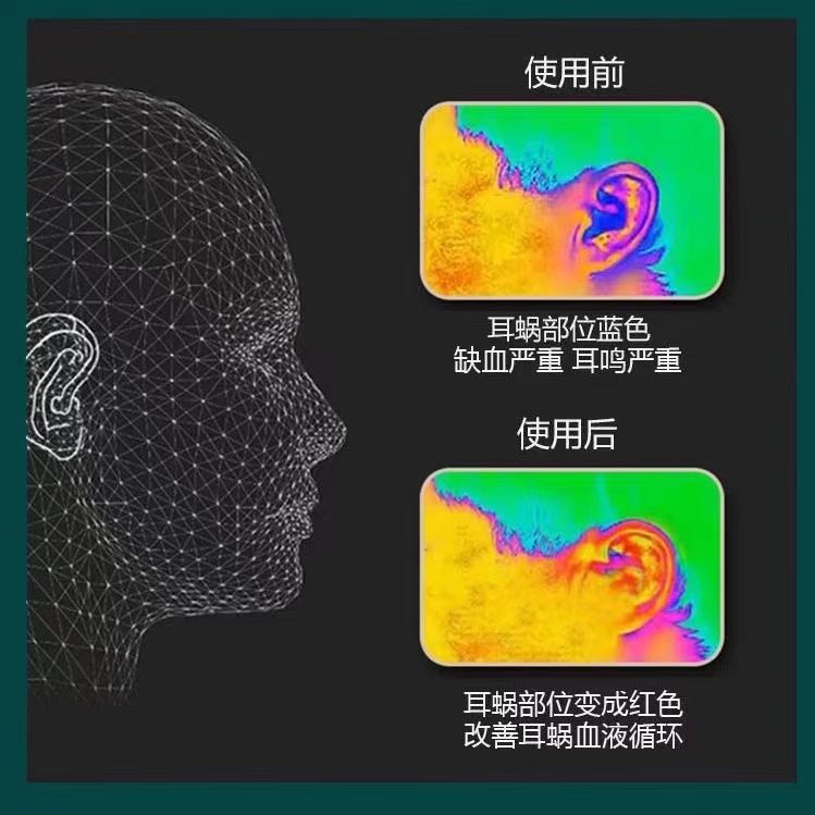 滴耳液人用耳朵痒流脓中耳道炎消药清洁液清洗液油耳鸣耳屎软化液 - 图0