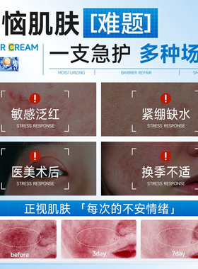 维生素b5舒缓保湿霜修复皮肤屏障保湿敏感肌肤受损修护脸部泛红