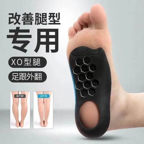 扁平足矫正鞋垫o型腿足底筋膜足外翻高足弓垫支撑神器矫正鞋垫 - 图3