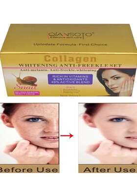 Snail Spot Removing Cream Fast Whitening face cream AB