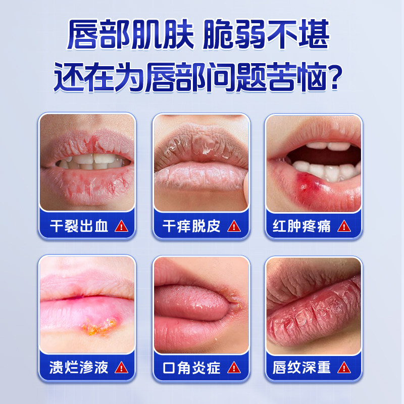 润唇膏唇炎专用唇膏嘴唇防干裂脱皮医用型男士女保湿滋润补水唇膏,淘宝优惠券,粉丝福利购,淘宝优惠卷