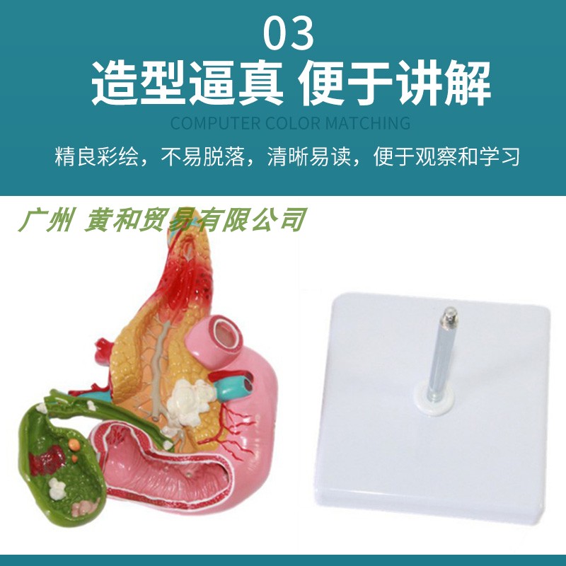 黄河胰腺十二指肠胆囊病理模型胆结实消化系统模型肝医学-图2