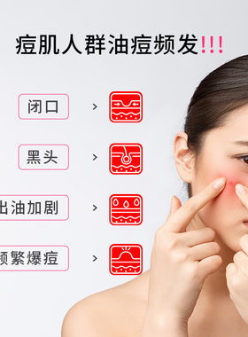 雪美清痘肌洗面奶男女学生缓解预防痘印不刺激温和清洁洁面乳120g