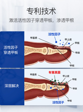美国Breathy布雷辛指甲液洋甘菊蓖麻油专用抗真菌正品