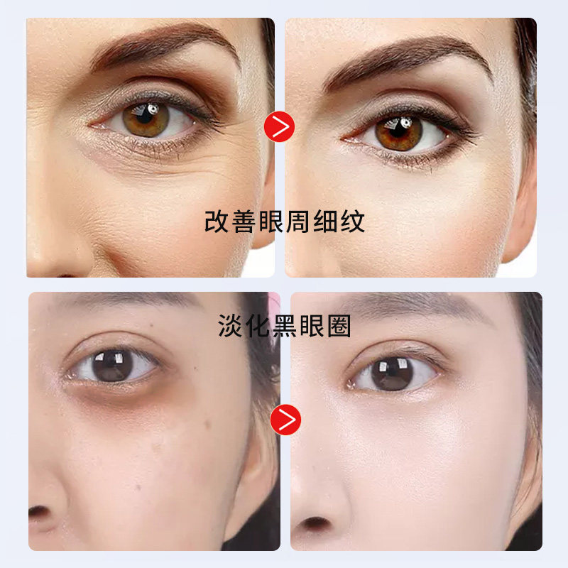 仁和蛇毒正品去除细纹抗皱男女眼霜 花琪眼霜