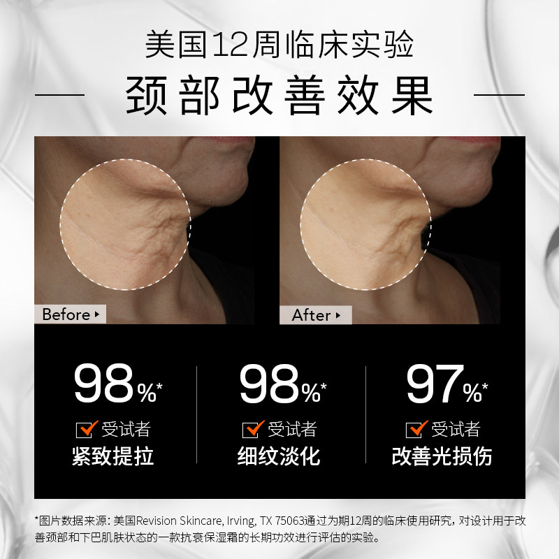 黎贝卡revisionskincare颈霜黑天鹅 revisionskincare海外颈霜