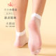 SK loose-mouthed fungus fashionable polka dot short stockings matte