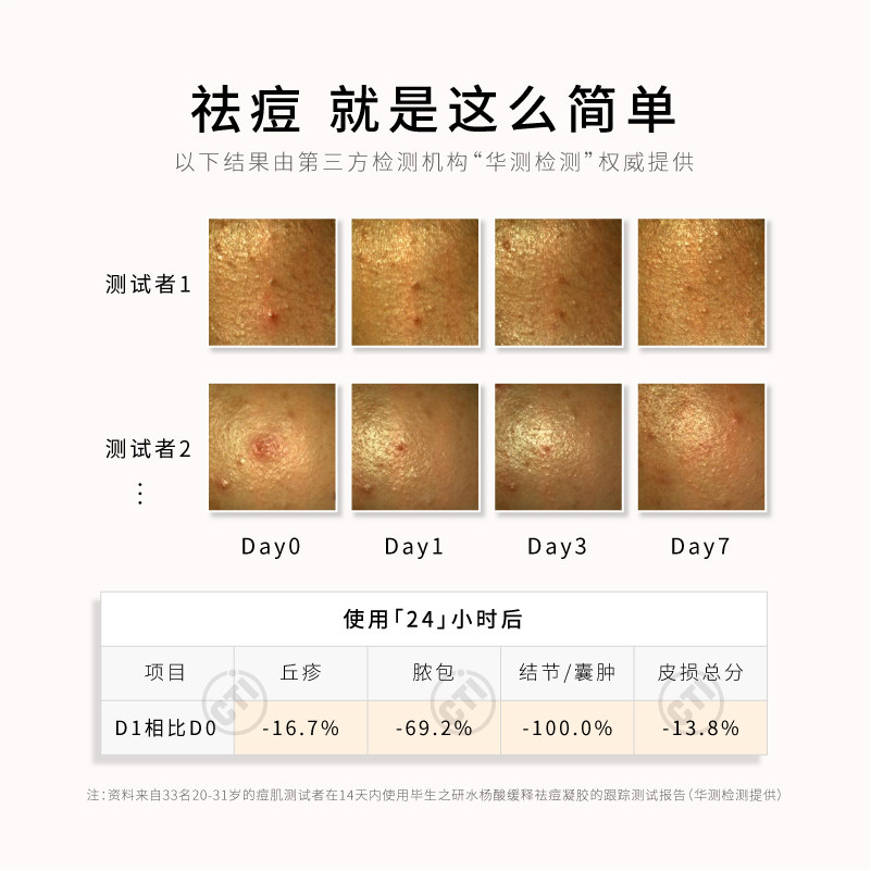 毕生之研2%水杨酸凝胶黑头痘痘贴 毕生之研液态精华