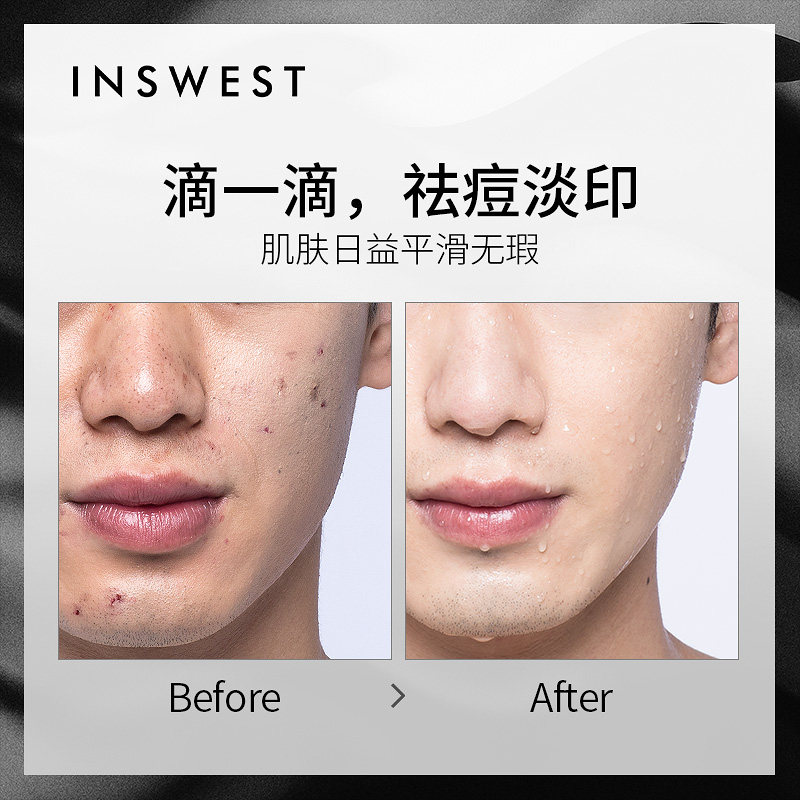 也西寡肽淡化痘印祛痘修复精华液 也西液态精华