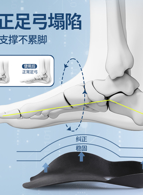 足弓垫女士足弓支撑鞋垫久站不累
