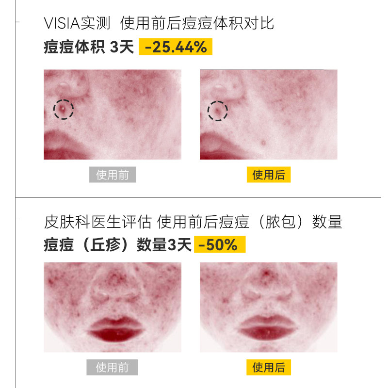 郁美净青少年棱角控油调理乳平衡痘痘闭口敏感肌专用补水护肤爽,淘宝优惠券,粉丝福利购,淘宝优惠卷