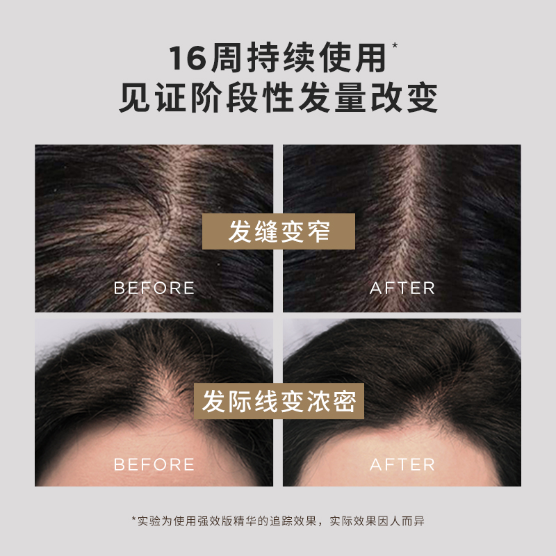 【60ml固发装】GrowGorgeous强效增发头皮精华育发赠130ml洗护礼