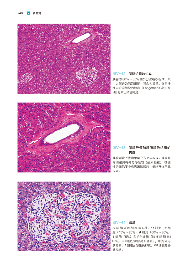 现货 活用于临床的病理诊断学 消化道 肝胆胰篇 第3版  日 福嶋 敬宜  二村 聡 苏弘博 等译 辽宁科学技术出版社9787559129628 - 图2