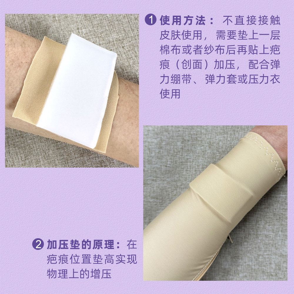 疤痕加压垫硅胶垫防疤痕增生儿童烧烫伤术后植皮加压平疤疤痕软垫,淘宝优惠券,粉丝福利购,淘宝优惠卷