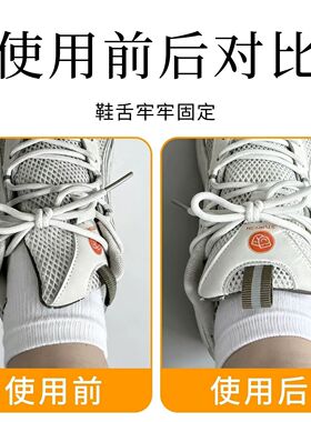 鞋舌固定器防歪神器反复用
