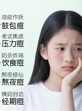 碧素堂壬二酸青少年祛痘乳温和控油舒缓保湿减少闭口痘痘乳