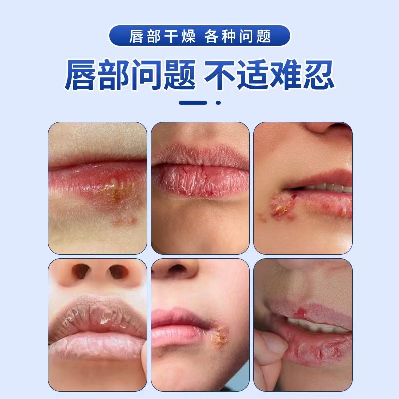 唇部护理软膏国药传承滋润唇部防干裂放脱皮保湿顺润药房正品lk1,淘宝优惠券,粉丝福利购,淘宝优惠卷