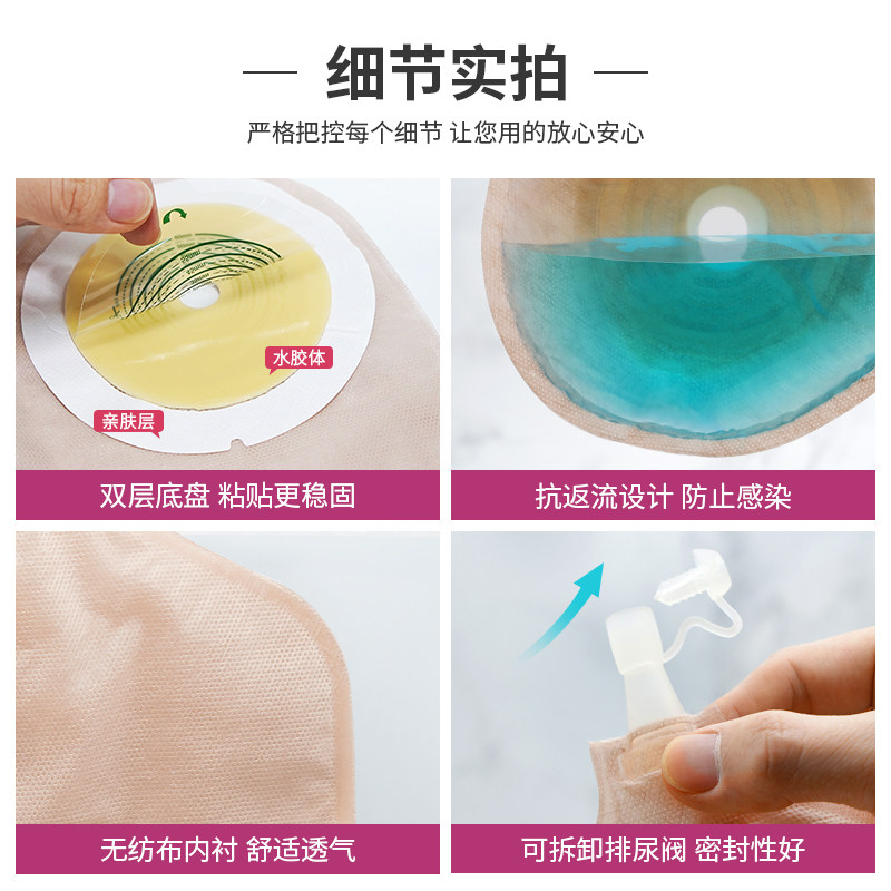隆泰一件式造口袋防反流护理接尿袋 innomed造口袋