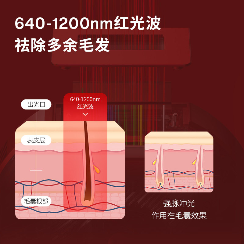 amiro觅光红光波脱毛仪强脉冲光 AMIRO觅光仟禧在线脱毛仪器