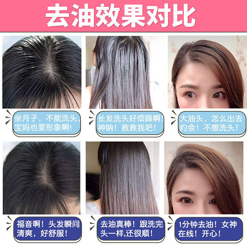 艾君蓬蓬粉免洗头发油头神器蓬松粉 艾君头发造型