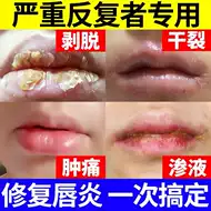 唇炎脱皮推荐品牌 新人首单立减十元 21年6月 淘宝海外