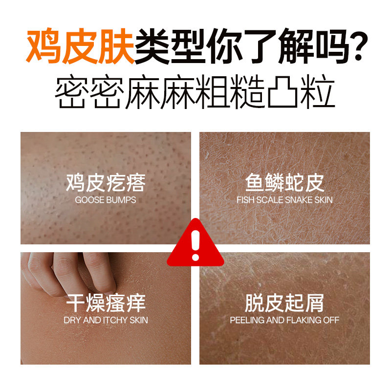 WEISL水杨酸舒润爽肤水改善鸡皮细腻皮肤护肤水