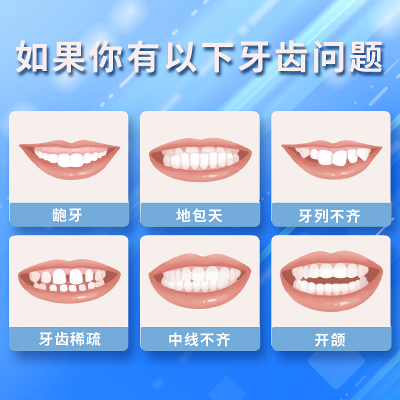 牙套定制牙齿矫正器透明夜间防磨牙钢套矫正器隐形正畸国产隐形 - 图1