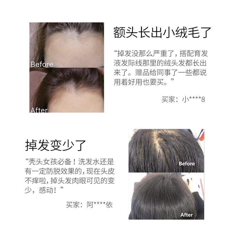 霸王育发防脱发套装控油男女洗头膏 霸王洗发水