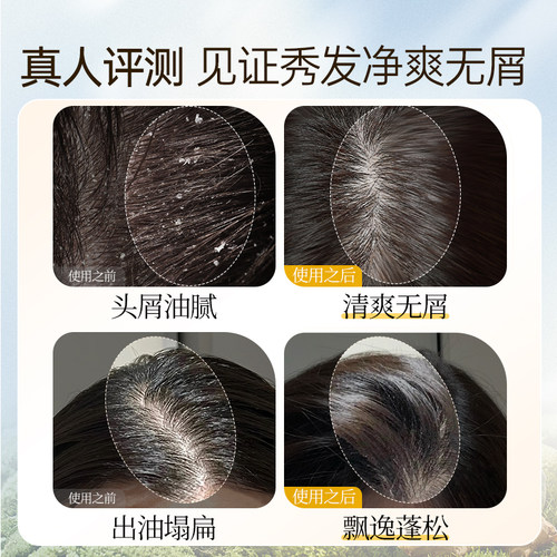 霸王姜汁首乌洗发水生姜控油蓬松洗发露头皮去屑止痒固发洗头膏女 - 图2