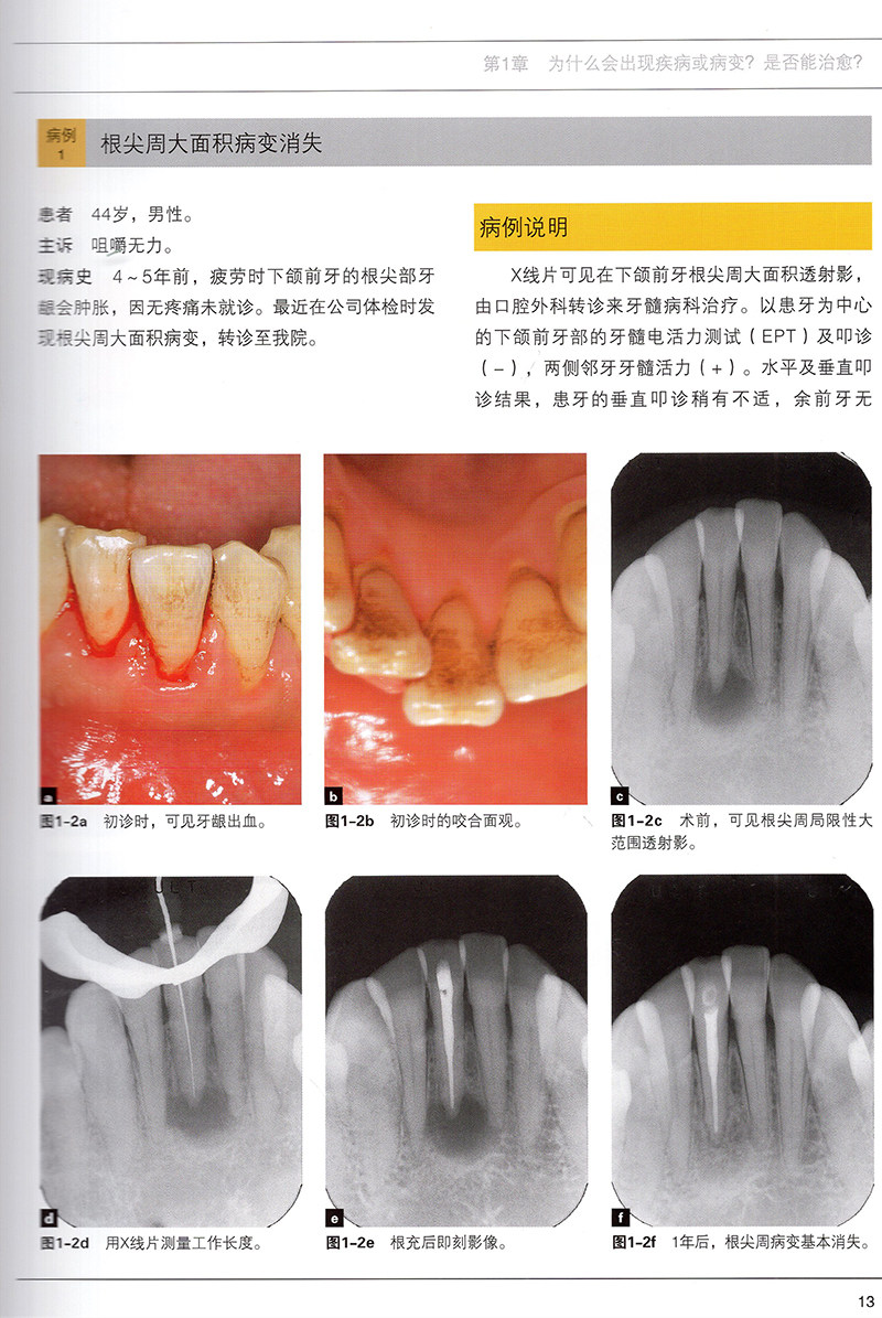 现货根管治疗失败的真实原因真正辽宁科学技术出版社临床医学口腔科牙体牙髓病预防诊断治疗教程牙齿种植畸形矫正手术技巧根管工具