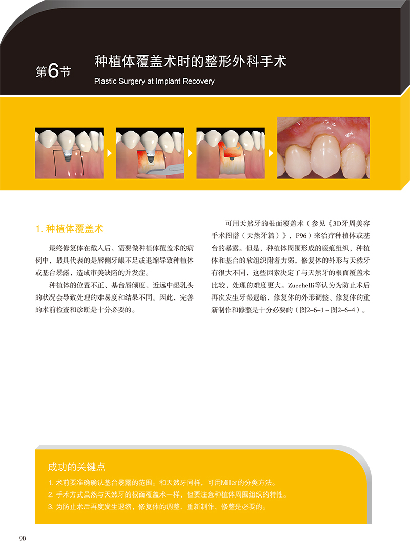 现货3D牙周美容手术图谱 种植 桥体篇配有真实的临床病例口腔种植医生的手边书冈田素平太等编著9787559117243T辽宁科学技术出版社 - 图1