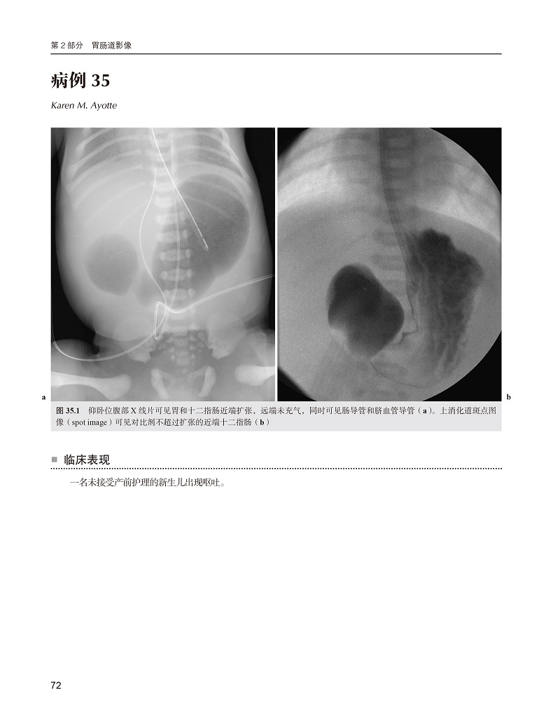 现货正版 儿科放射学Top3鉴别诊断 病例荟萃与分析 吴新淮赵倩北京大学医学出版社9787565925887 - 图2