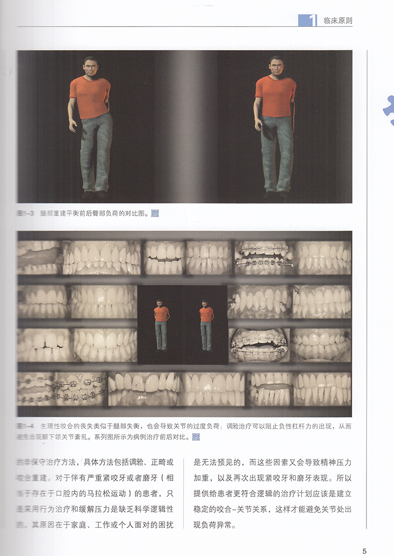 现货正版精装天然牙列和种植体的调治疗三维咬合西班牙牙合维森特 希门尼斯-洛佩兹 Vicent 辽宁科学技术出版社9787559110930 - 图3