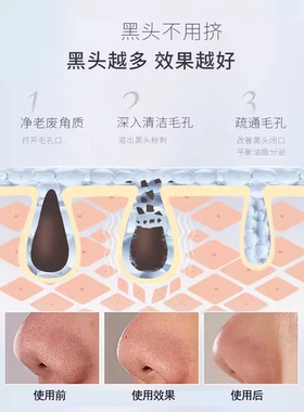 防伪可查】麦吉丽去黑头水深层清洁T区控油收毛孔分解酒糟草莓鼻