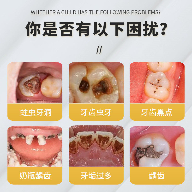 儿童小孩宝宝蛀牙牙洞清理虫牙智齿清理牙洞克星喷雾牙齿清洁神器-图0