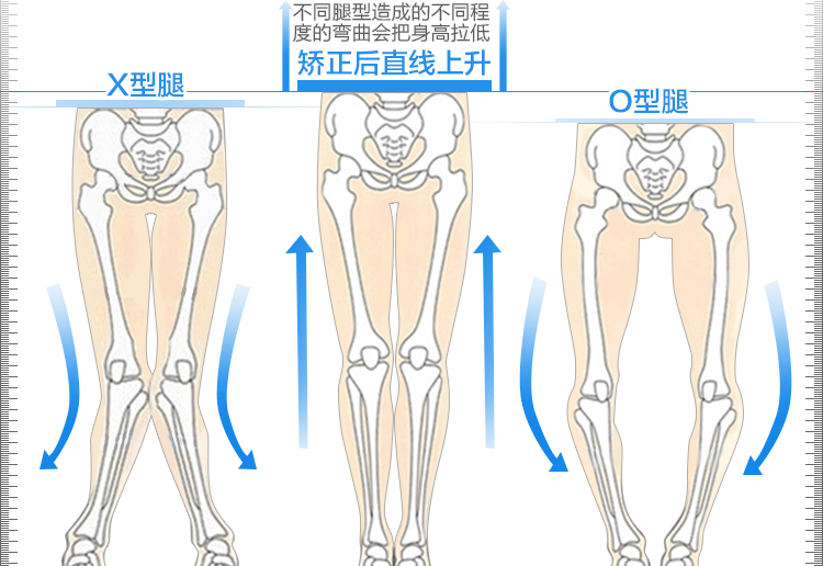 带腿矫正儿童O型腿矫型器 仙享科技 淘宝特价大促销打折疯抢! - 图3