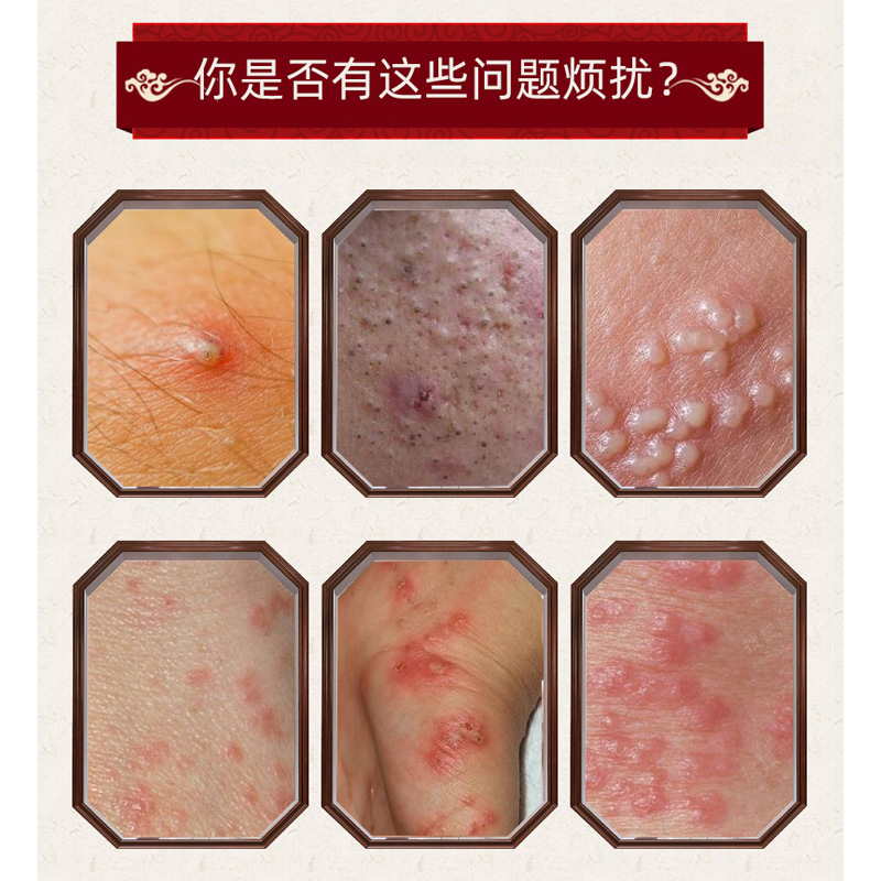 硫磺软膏止痒一扫光阴囊去阴虱疥虫 康健医疗器械专营皮肤消毒护理（消）