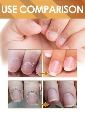 NailReprGCuticSofnAnd
