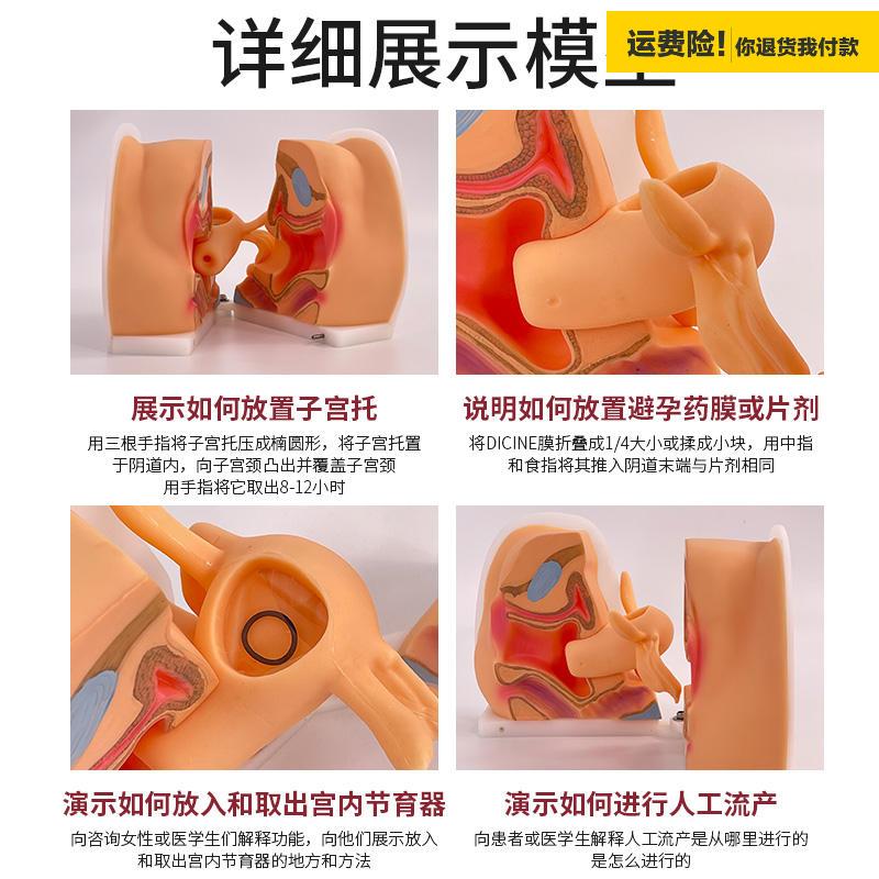 .女性生殖器模型宫颈子宫阴道卵巢妇科检查生殖私密教学1比1软硅 - 图1