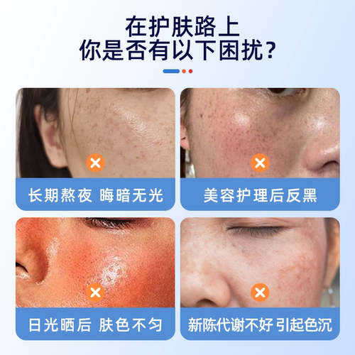 氨甲环酸湿敷液传明酸5%原液精华液补水提亮湿敷氨甲环酸软膏乳膏 - 图0