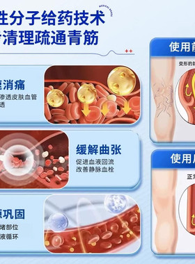 静脉曲张药膏青筋凸起红血丝专特用效外用冷敷凝胶官方正品