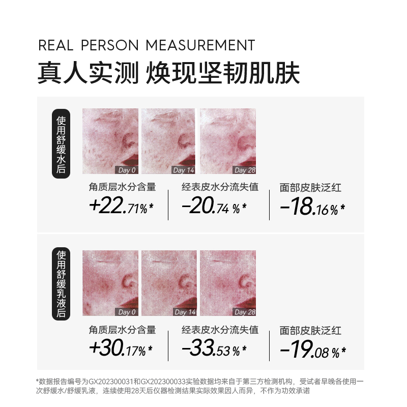 德妃紫苏水乳洁面套装 修护维稳 补水秋冬控油 修红滋润 水油平衡