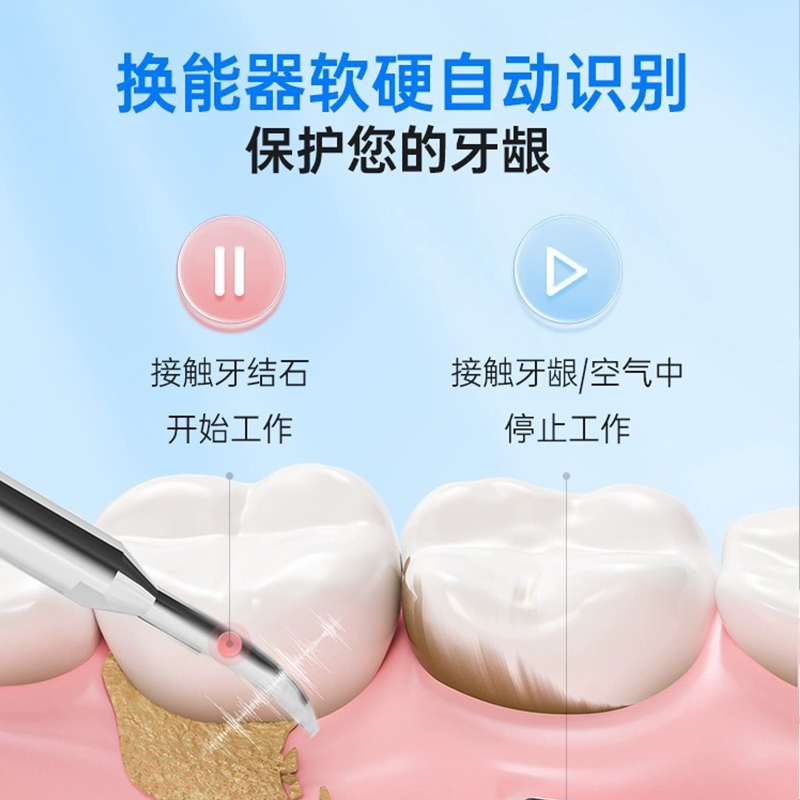 康佳冲牙器超声波家用除牙结石洁牙仪电动清洗牙齿牙渍污垢正JX2 - 图2